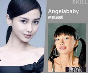 梅州整容爆料案件最新,揭开美容行业潜规则与维权困境